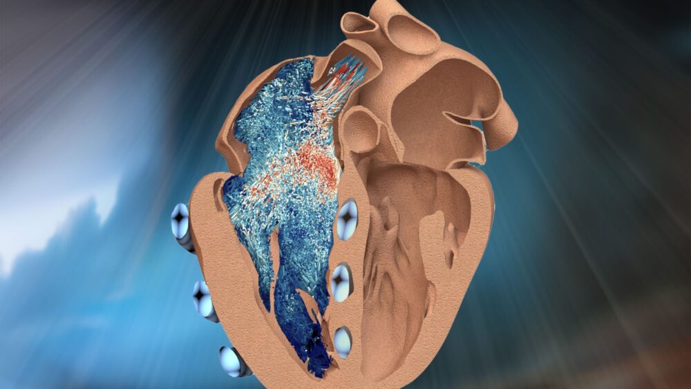 Así es la réplica robótica del ventrículo derecho del corazón Con I