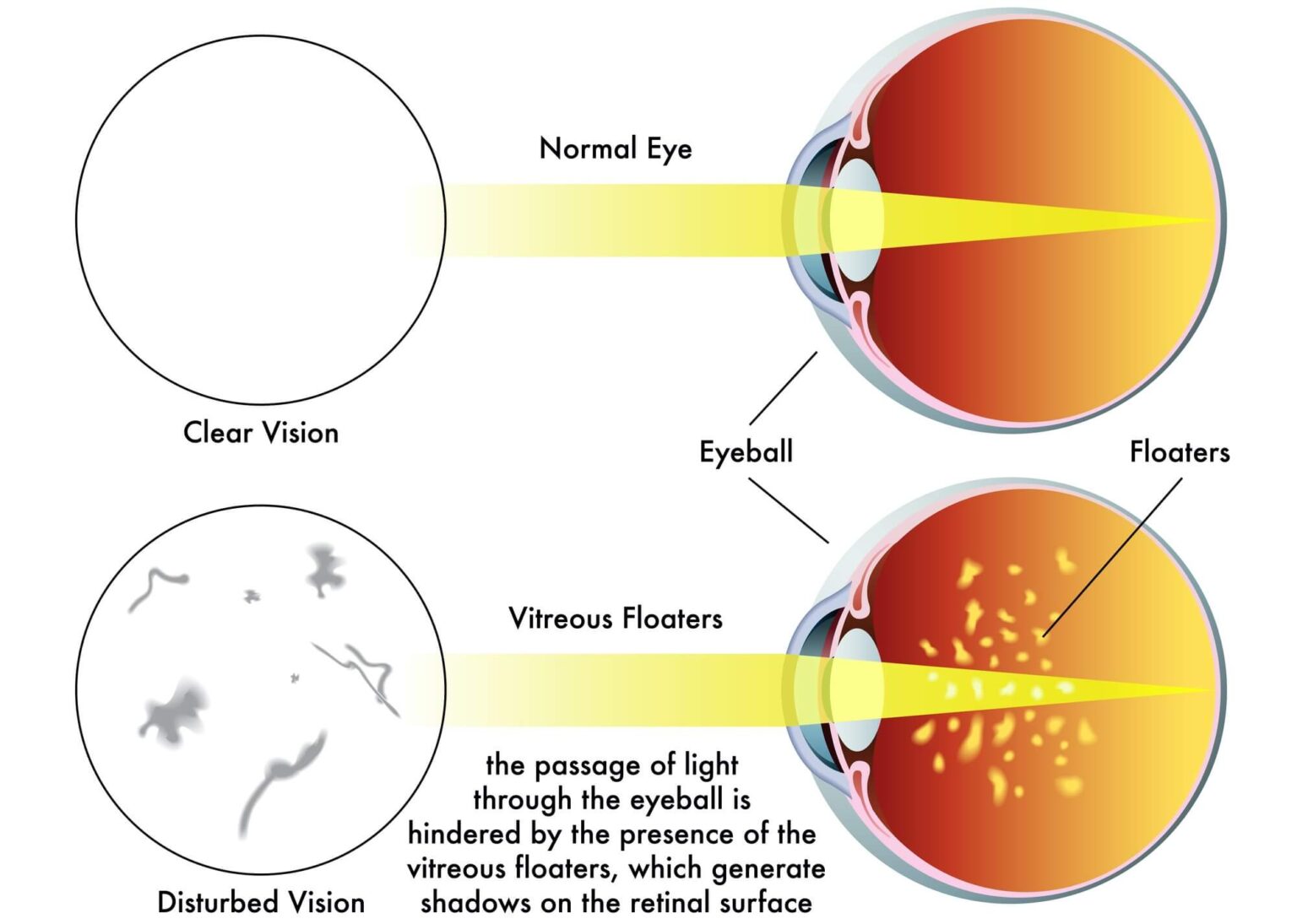 why-do-you-see-flashing-lights-in-your-eyes-homeminimalisite