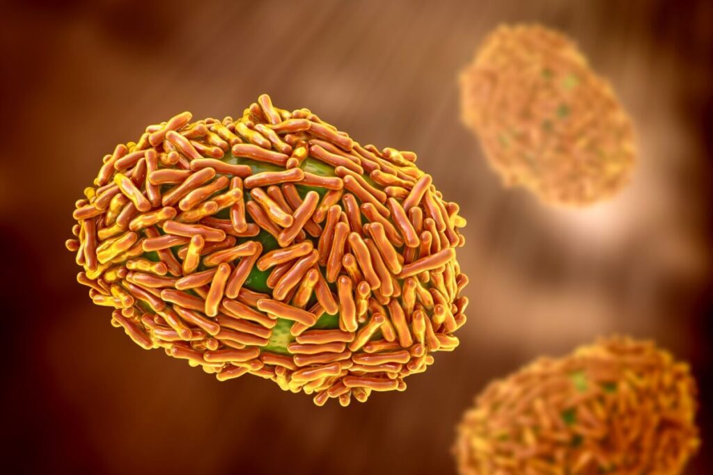 ¿Por qué el diagnóstico de la viruela del mono o MPOX es una prioridad mundial?