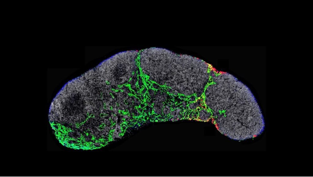 ¡Así lucha el talento científico contra el agresivo melanoma!