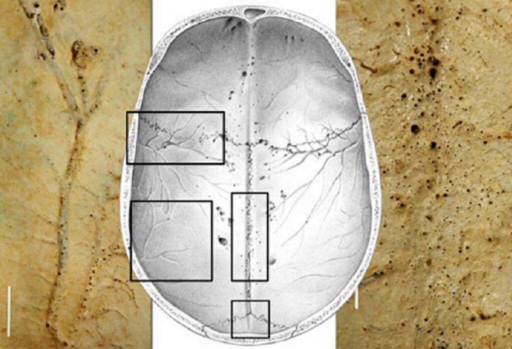 Diminutos canales del cráneo y sus funciones en la salud cerebral