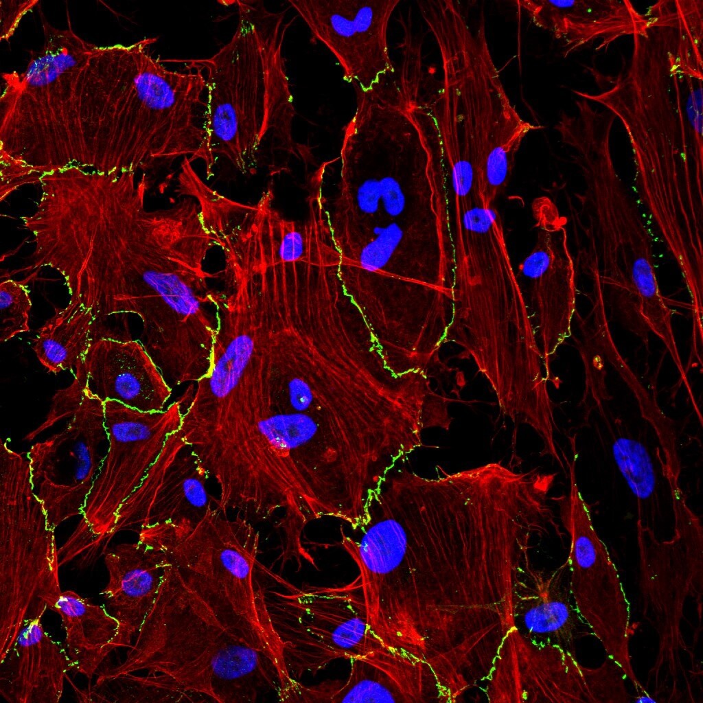 Hidrogel en spray para prevenir complicaciones tras cirugía abdominal. Además de funcionar como una barrera física que evita que los órganos se adhieran entre sí, actúa como modulador biológico.