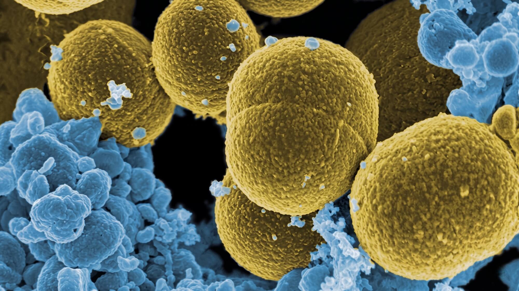 ¿Por qué las bacterias más "pegajosas" causan infecciones menos graves? El Instituto de Biomedicina de Valencia (IBV-CSIC) revela que la capacidad de la bacteria Staphylococcus aureus para adherirse a proteínas del organismo y producir toxinas determina la gravedad de la infección sanguínea.