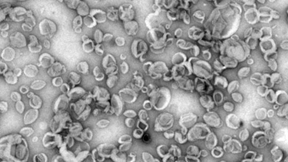 Un trabajo del Centro de Biología Molecular Severo Ochoa (CBM-CSIC-UAM) ha desarrollado una nueva plataforma de vacunas basada en nanovesículas sintéticas que imitan el comportamiento de las vesículas extracelulares que las utilizan para comunicarse entre sí.
