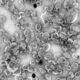 Un trabajo del Centro de Biología Molecular Severo Ochoa (CBM-CSIC-UAM) ha desarrollado una nueva plataforma de vacunas basada en nanovesículas sintéticas que imitan el comportamiento de las vesículas extracelulares que las utilizan para comunicarse entre sí.