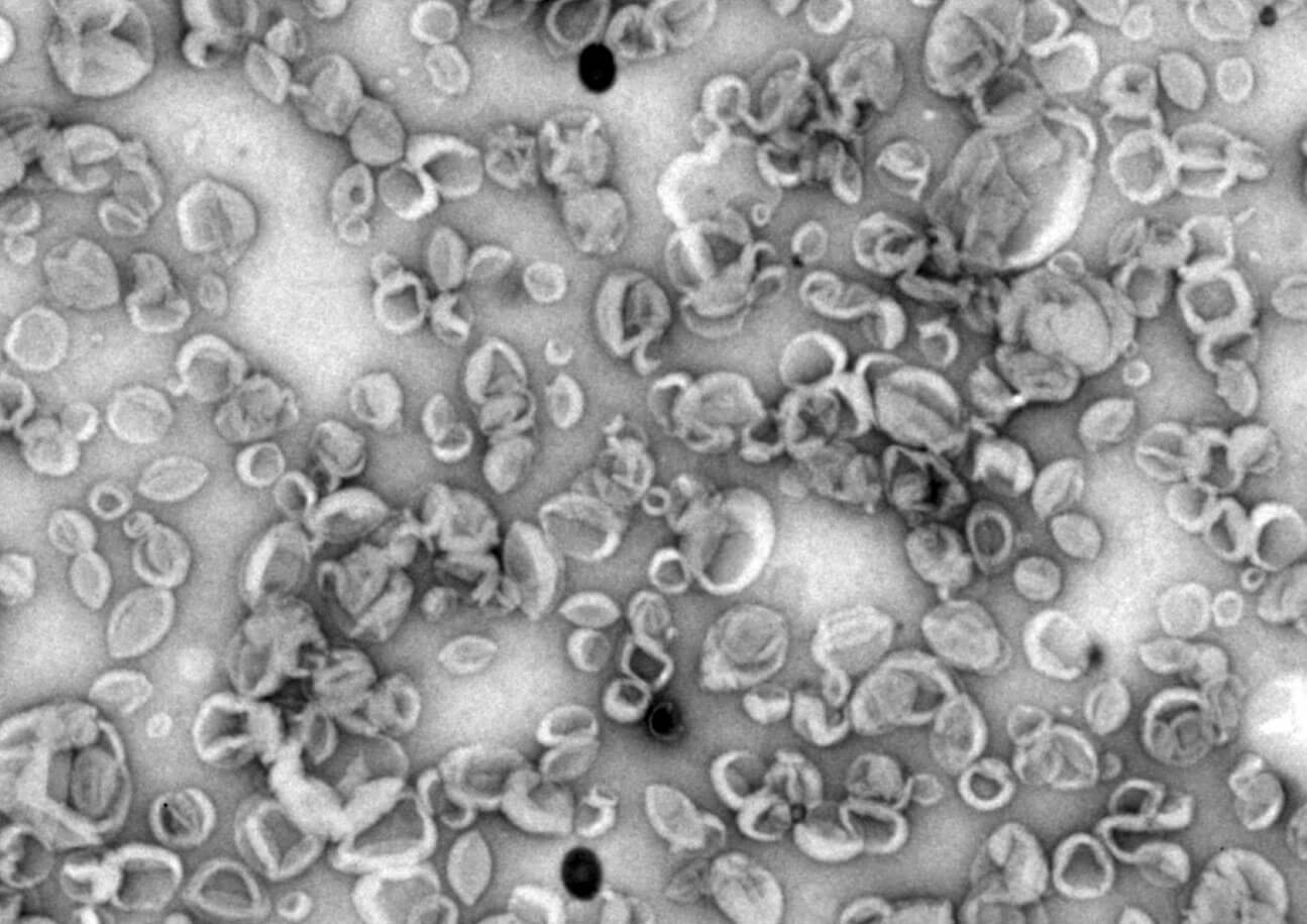 Un trabajo del Centro de Biología Molecular Severo Ochoa (CBM-CSIC-UAM) ha desarrollado una nueva plataforma de vacunas basada en nanovesículas sintéticas que imitan el comportamiento de las vesículas extracelulares que las utilizan para comunicarse entre sí.